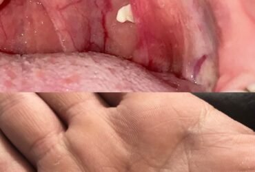 493084619 122167449398480977 8257324858791289787 n