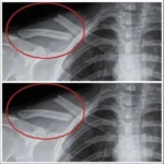 8 choses qui arrivent a votre corps lorsque vous arretez de boire du soda light 1.jpg