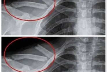 8 choses qui arrivent a votre corps lorsque vous arretez de boire du soda light 1.jpg