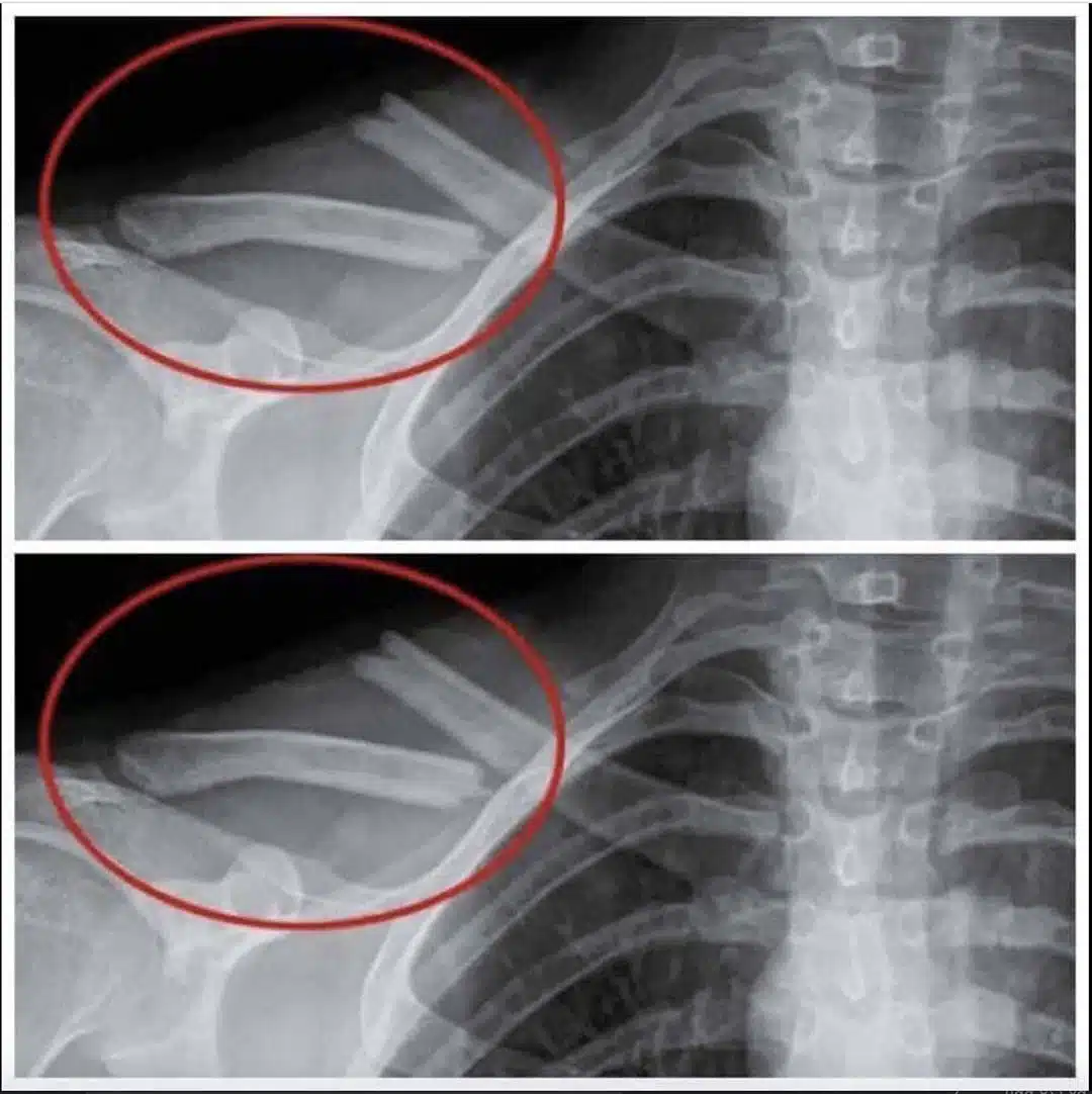 8 choses qui arrivent a votre corps lorsque vous arretez de boire du soda light 1.jpg