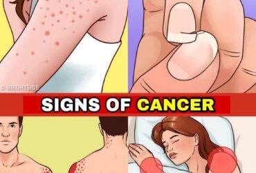 98f2b7ec c31d 476a 8f57 d6fc20569aef