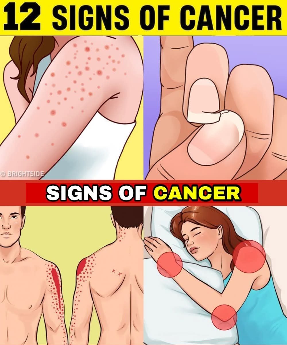 12 Early Warning Signs Your Body May Be Developing Cancer Cells 25 98f2b7ec c31d 476a 8f57 d6fc20569aef