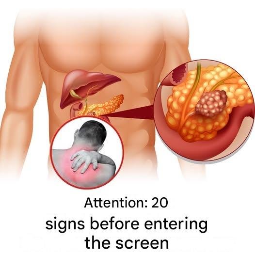 13298098 eb0d 4a1d 8b93 777f21a2a33e